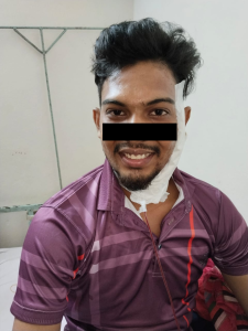 Parotid Surgery and facial nerve